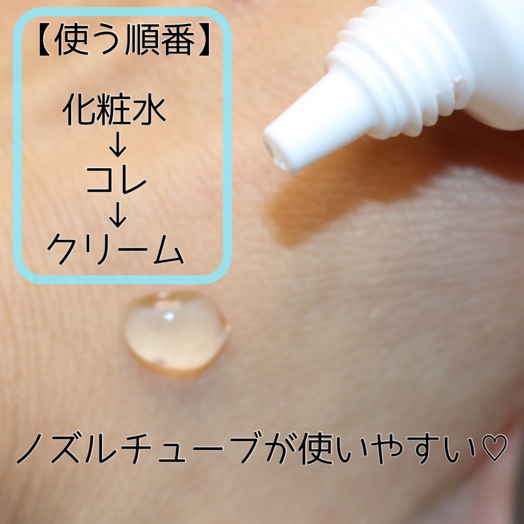 FEG アゼライン酸 15%配合 クリアスキンクリームA /FEG/フェイスクリームを使ったクチコミ(4枚目)