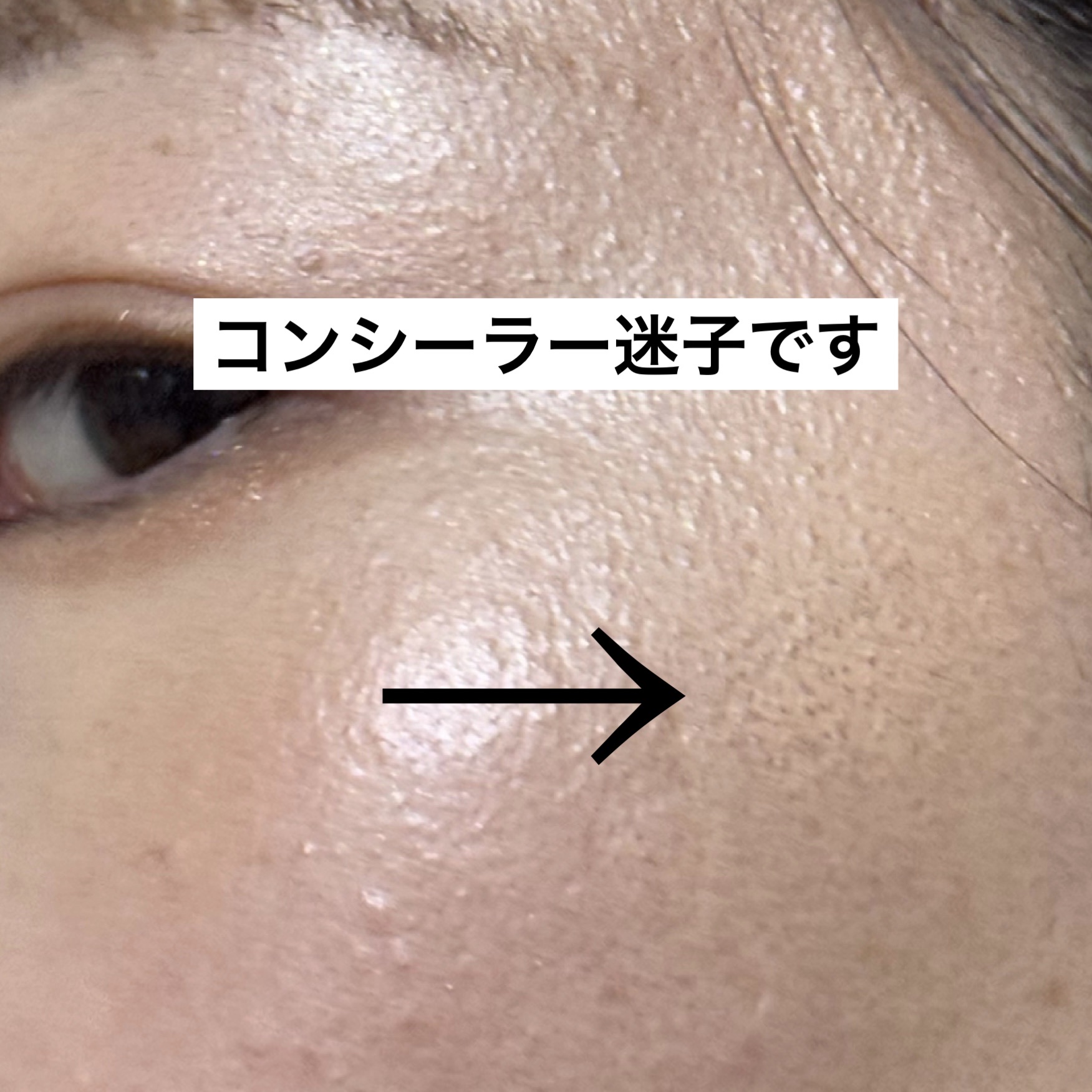 リアル フローレス ウェイトレス パーフェクティング コンシーラー/ローラ メルシエ/リキッドコンシーラーを使ったクチコミ（1枚目）