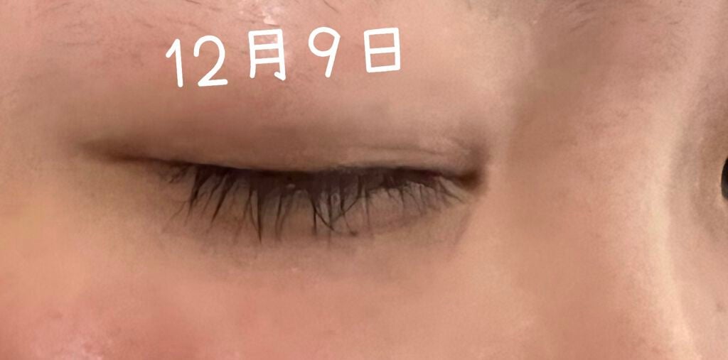 エターナルアイラッシュ/リュバンブラン/まつげ美容液を使ったクチコミ(4枚目)
