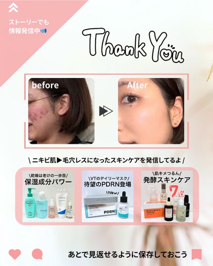 ガラクトミーエッセンスクリーム/manyo/フェイスクリームを使ったクチコミ(10枚目)