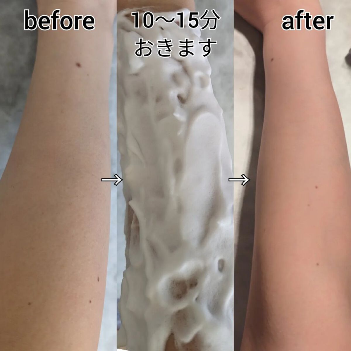 ホイップリムーバー/BODYPLEX/除毛クリームを使ったクチコミ（2枚目）