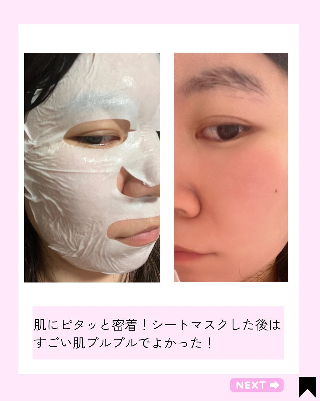 センシティブグルーマスク/uthly/シートマスク・パックを使ったクチコミ(5枚目)