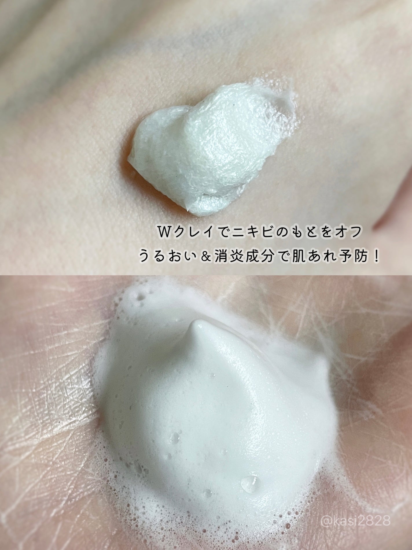 ロゼット洗顔パスタ アクネクリア/ロゼット/洗顔フォームを使ったクチコミ(2枚目)