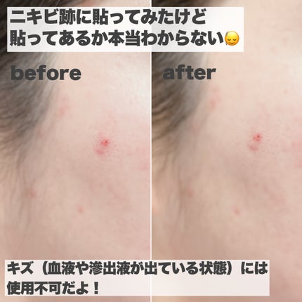 filmor/filmor/日焼け止めローションを使ったクチコミ(5枚目)