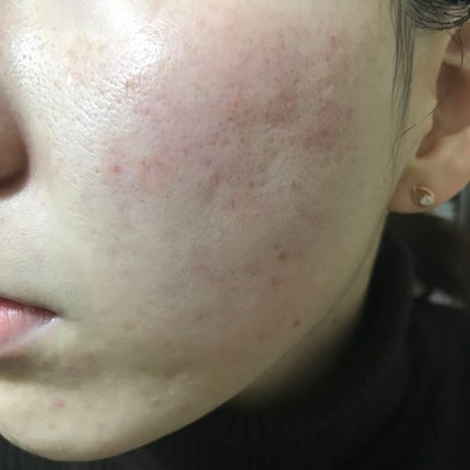 マデカソ 美容液/A’pieu/美容液を使ったクチコミ(2枚目)