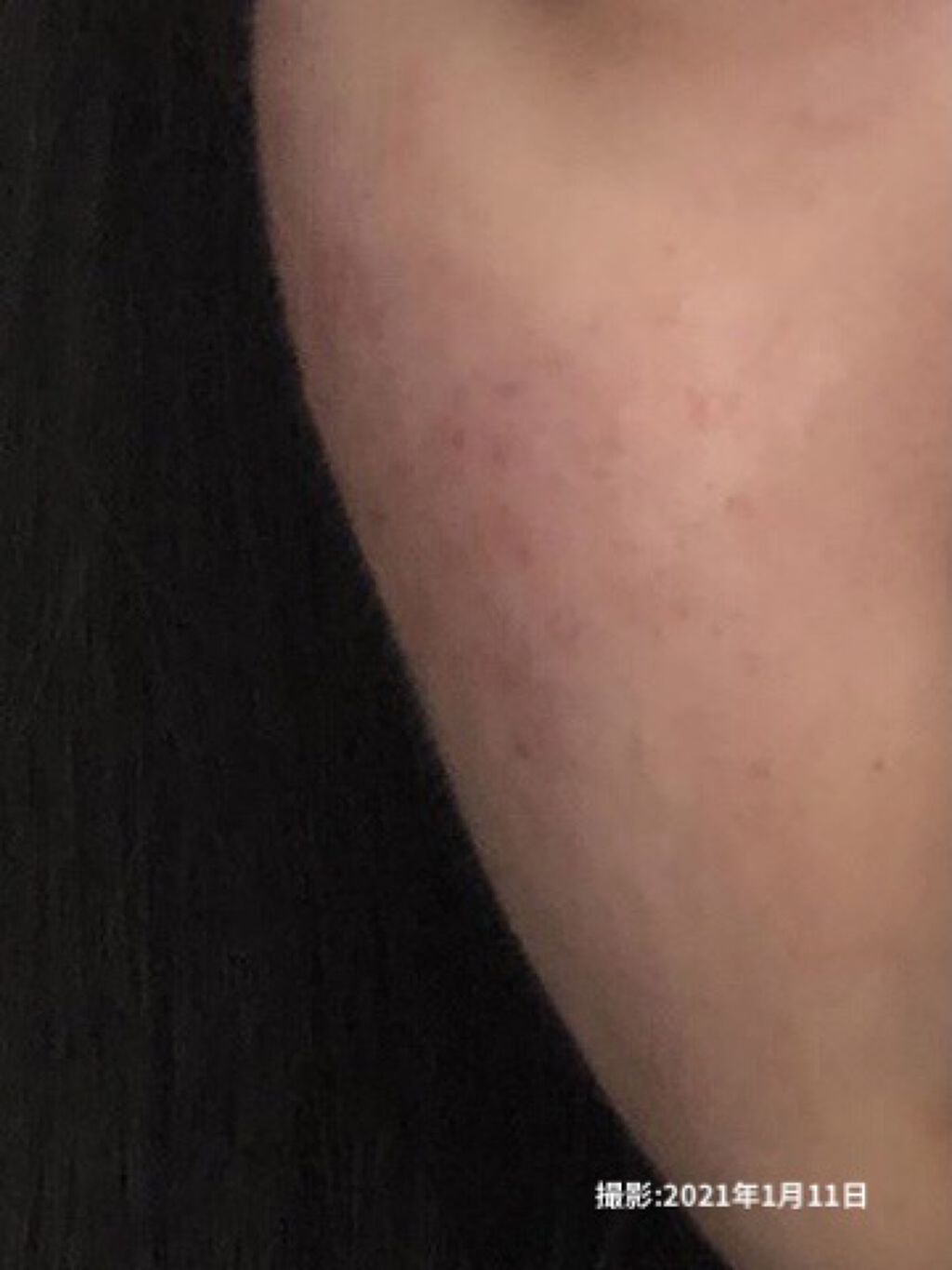 白色ワセリン(医薬品)/健栄製薬/その他を使ったクチコミ（2枚目）