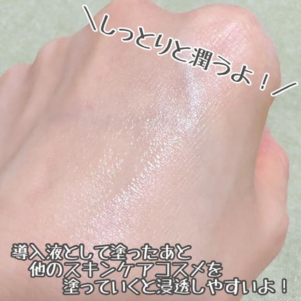 リードルショット100/VT/美容液を使ったクチコミ(4枚目)