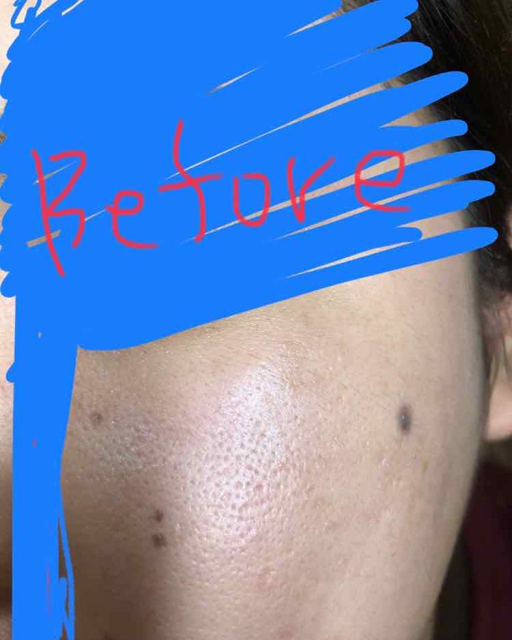 グリセリン/大洋製薬/その他を使ったクチコミ（3枚目）