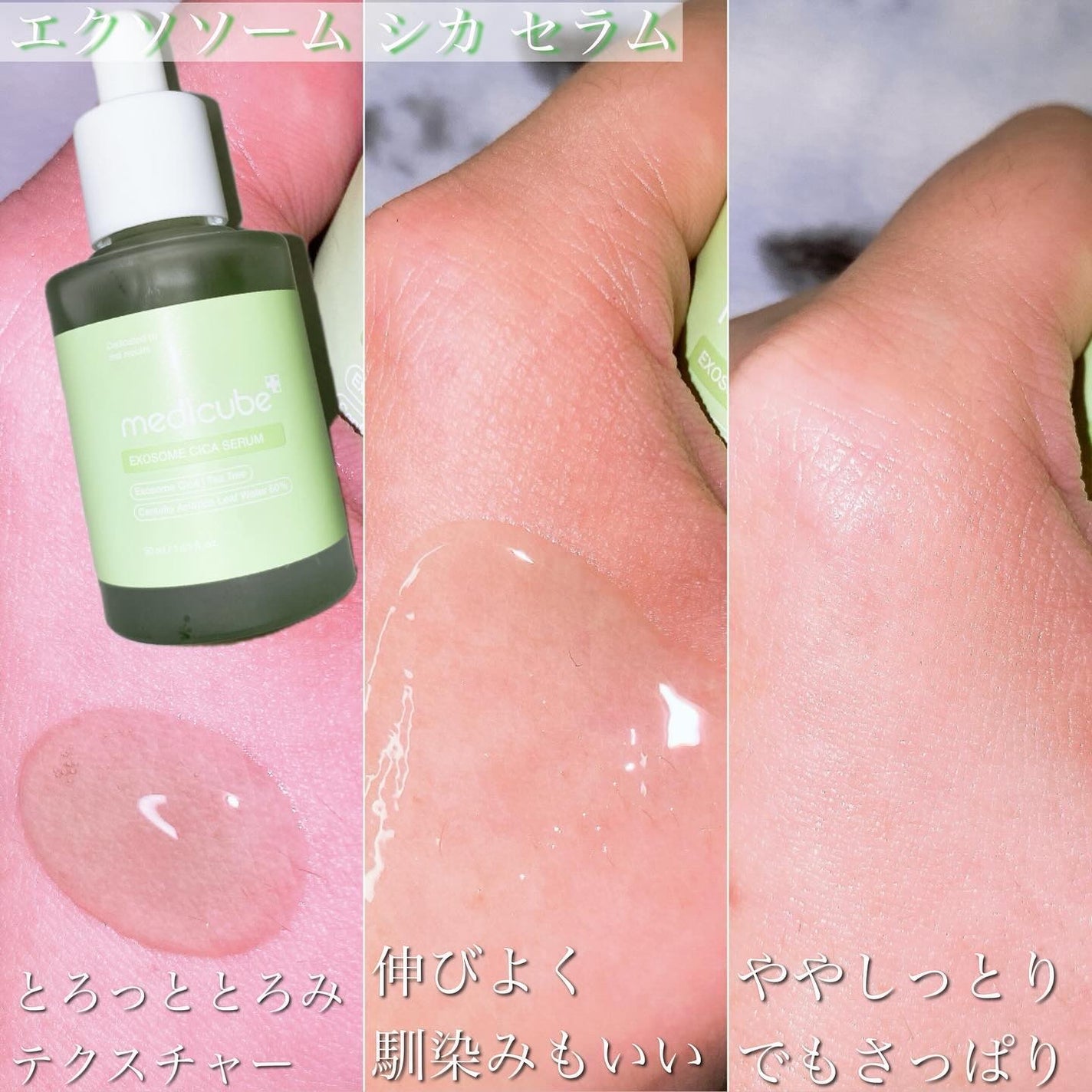 kirakira_kirarasama on LIPS 「_medicubeEXOSOMECICATONERメディキュー..」(6枚目)