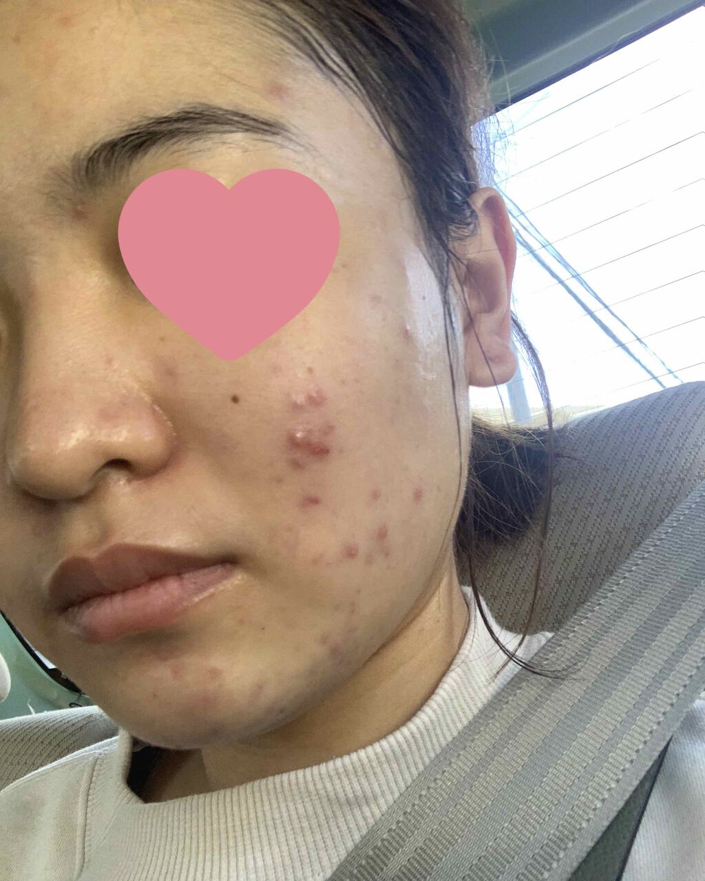 ドクタージャルト シカペア クリーム （第2世代）/Dr.Jart＋/フェイスクリームを使ったクチコミ（1枚目）