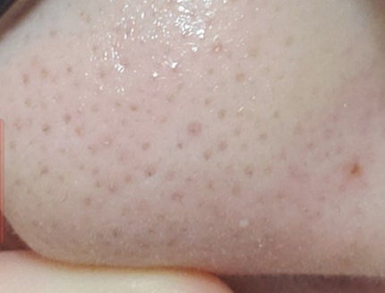 クリーンイットゼロ クレンジングバーム オリジナル/BANILA CO/クレンジングバームを使ったクチコミ(3枚目)