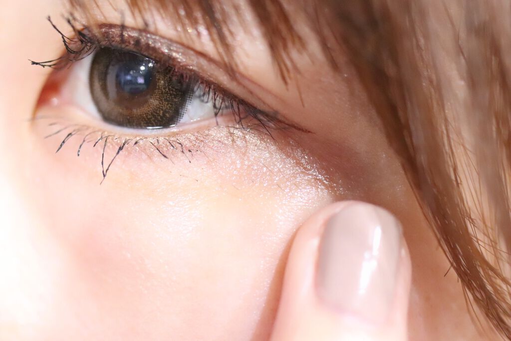 リンクルショット メディカル セラム N/リンクルショット/アイケア・アイクリームを使ったクチコミ(4枚目)