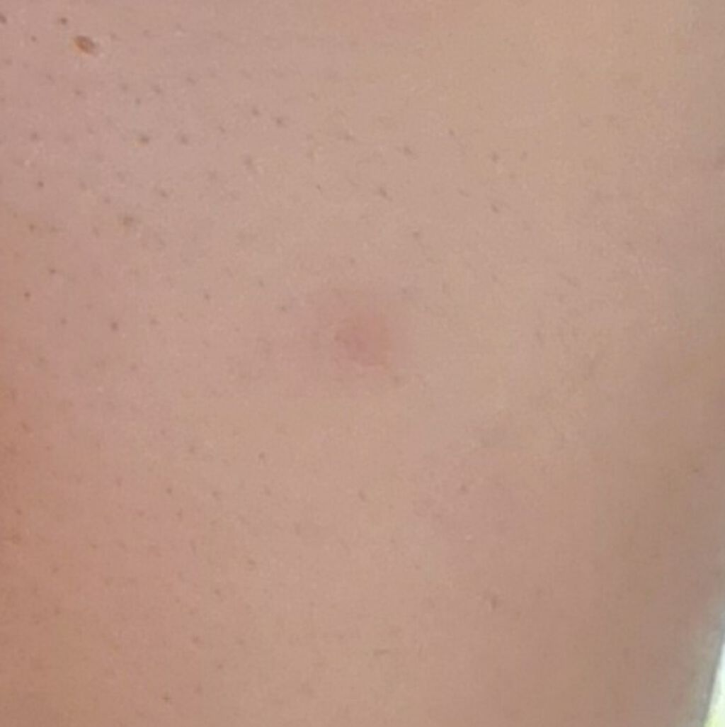 スティックコンシーラーA/KATE/スティックコンシーラーを使ったクチコミ（3枚目）