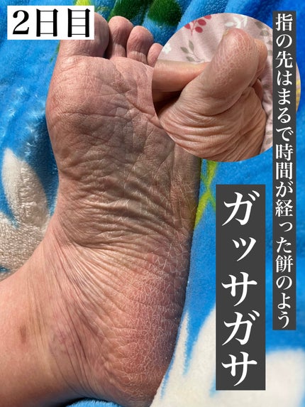 イージーパックDP60分タイプ/ベビーフット/レッグ・フットケアを使ったクチコミ(6枚目)