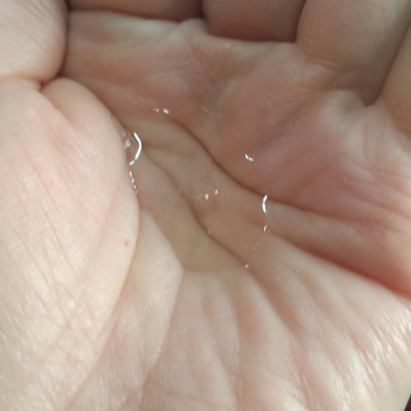 薬用 リペア ローション/アクネオ/化粧水を使ったクチコミ(3枚目)