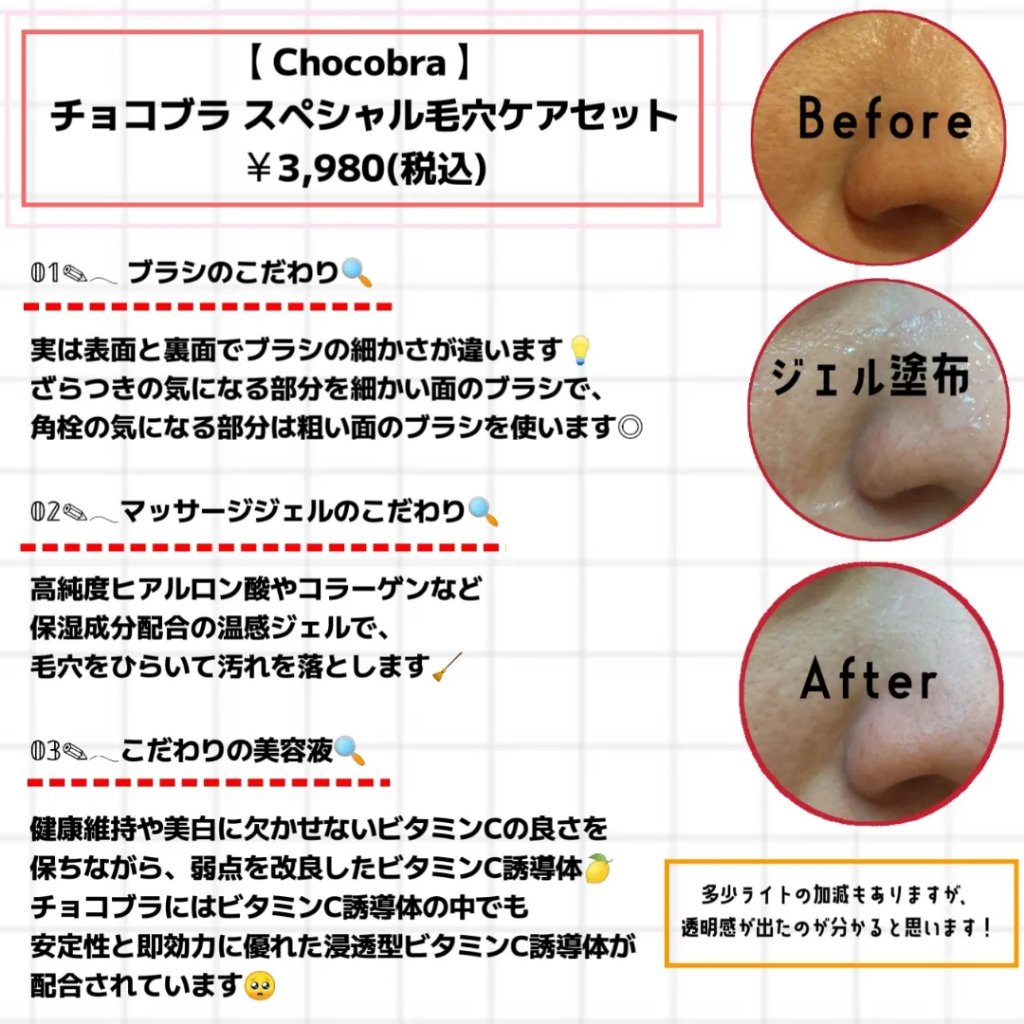 チョコブラ スペシャル毛穴ケアセット/Chocobra/スキンケアキットを使ったクチコミ（2枚目）