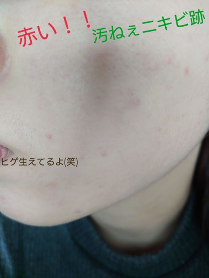 ダブルラスティング セラムファンデーション/ETUDE/リキッドファンデーションを使ったクチコミ(2枚目)