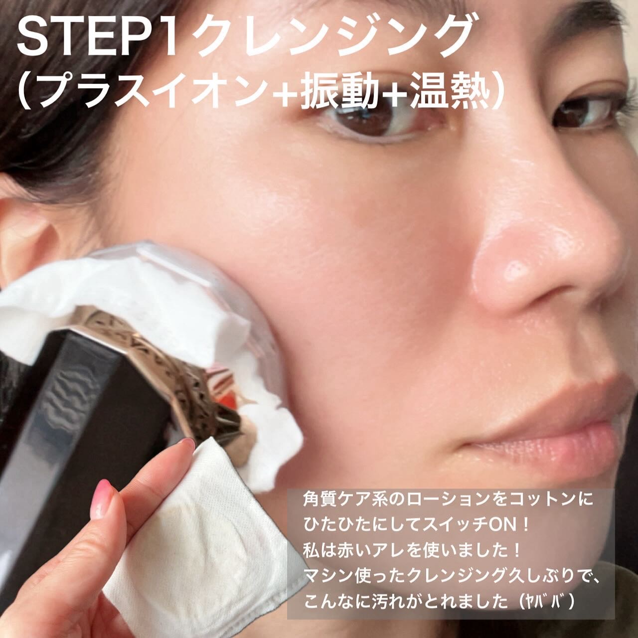 RF温冷美顔器PRO/ANLAN/美顔器・マッサージを使ったクチコミ（3枚目）