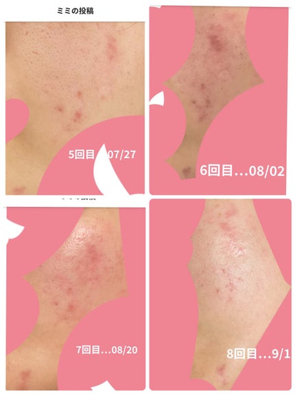 もち肌コラーゲンセラム3.0/MEDICUBE/美容液を使ったクチコミ(4枚目)