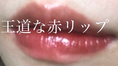 皮膚科医監修 唇の黒ずみの原因と対策 市販のおすすめリップやスクラブ10選も紹介 Lips 皮膚科医監修 唇の黒ずみの原因と対策 市販のおすすめリップやスクラブ10選も紹介 Lips