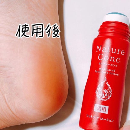 ネイチャーコンク薬用フットケアローション/ネイチャーコンク/レッグ・フットケアを使ったクチコミ(4枚目)