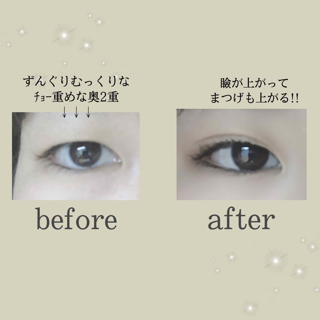 メッシュ アイテープ/shefun/二重まぶた用アイテムを使ったクチコミ（3枚目）