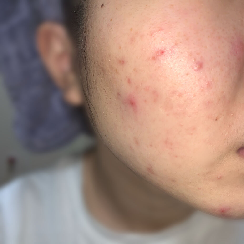 明色美顔水 薬用化粧水/美顔/化粧水を使ったクチコミ（2枚目）