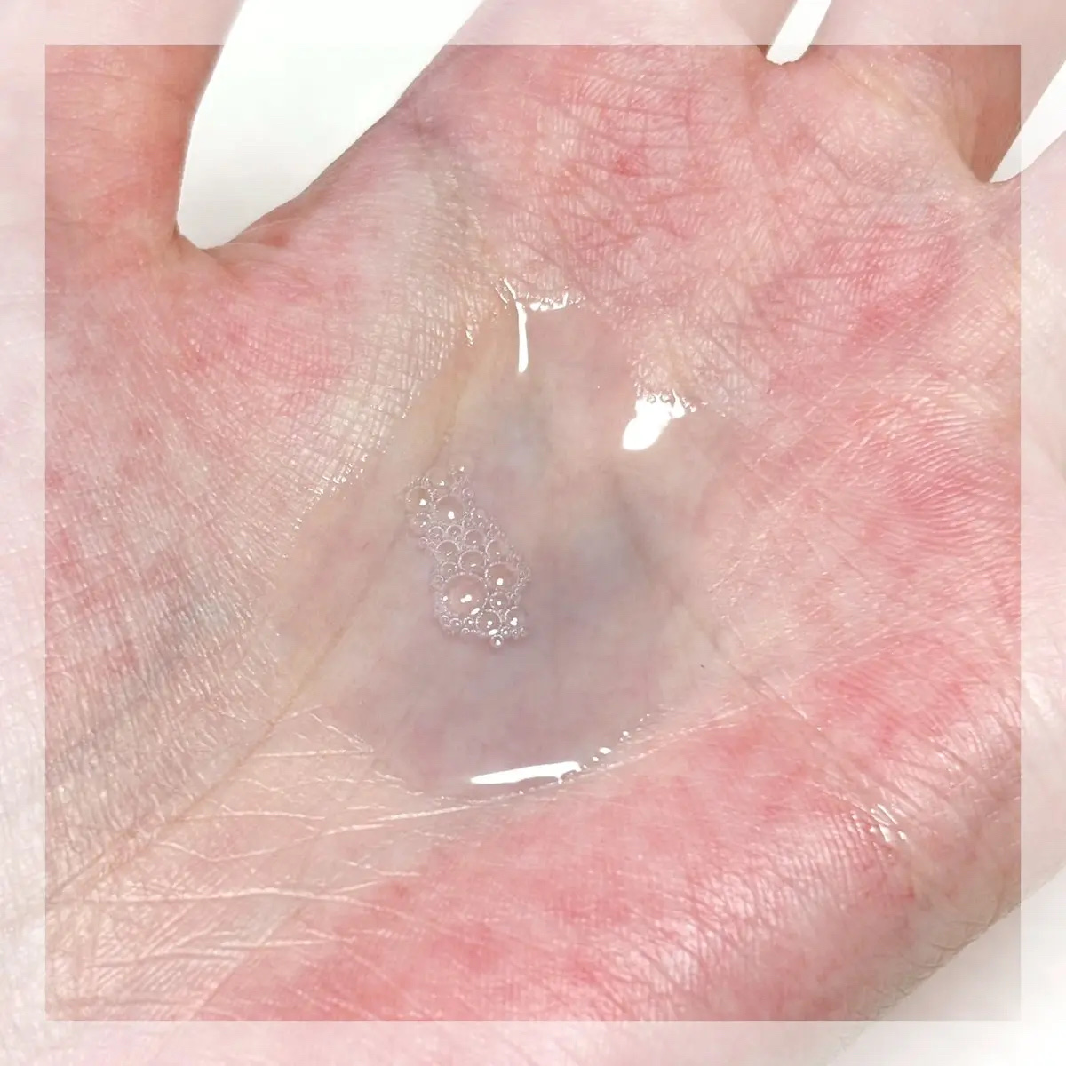 ゼロ毛穴1DAYセラム/MEDICUBE/美容液を使ったクチコミ（3枚目）