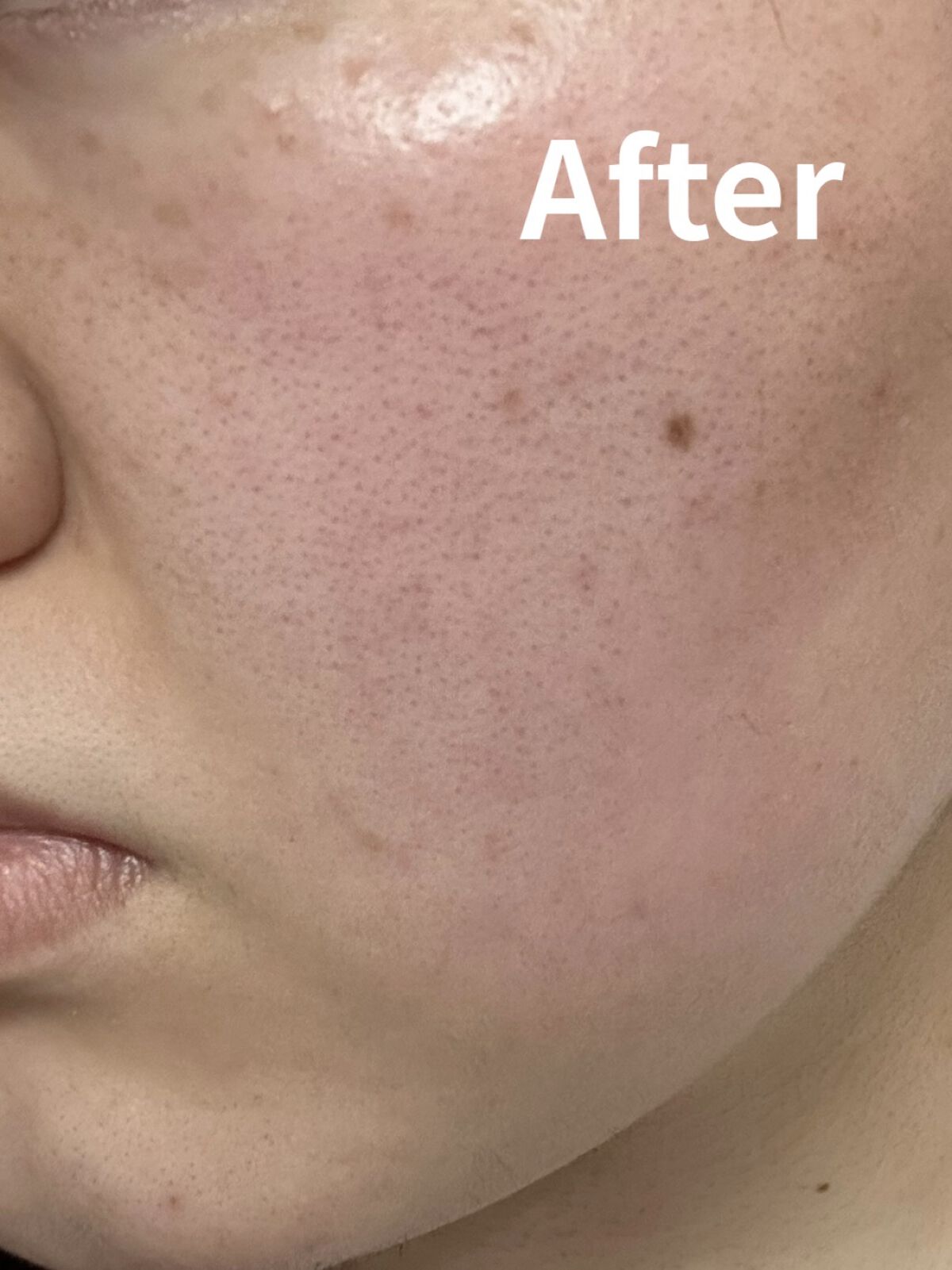 ヘパトリート 薬用保湿化粧水/ゼトックスタイル/化粧水を使ったクチコミ（2枚目）