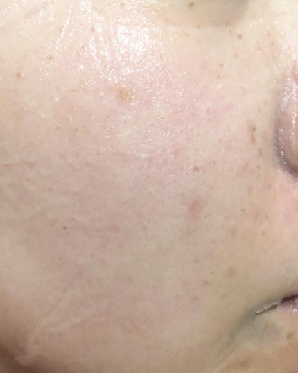 パーフェクトバランシング ビタミンゼリーマスク/ネイチャーリパブリック/シートマスク・パックを使ったクチコミ(6枚目)