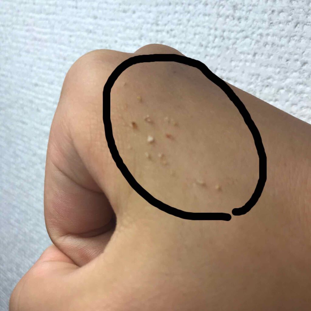 明色美顔水 薬用化粧水/美顔/化粧水を使ったクチコミ(3枚目)