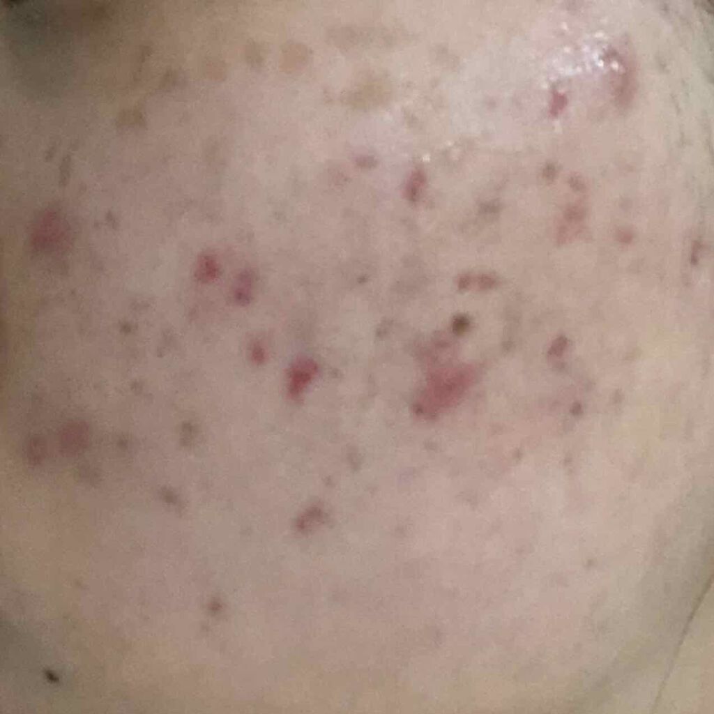 ヴァセリン アドバンスドリペア ボディローション 無香料/ヴァセリン/ボディローションを使ったクチコミ（2枚目）