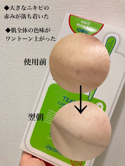 ティーツリーケア ソリューション エッセンシャルマスクEX/MEDIHEAL/シートマスク・パックを使ったクチコミ(2枚目)