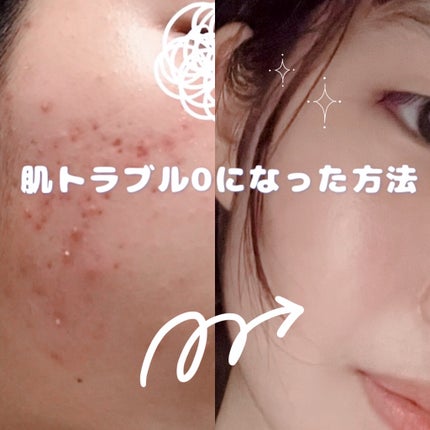 3ミニッツマスク:カーマイド with ティーツリー/MEDIHEAL/シートマスク・パックを使ったクチコミ(1枚目)