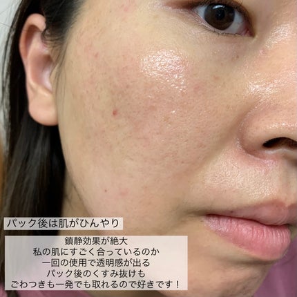 ドクダミ77 % 鎮静マスクパック/Anua/シートマスク・パックを使ったクチコミ(7枚目)