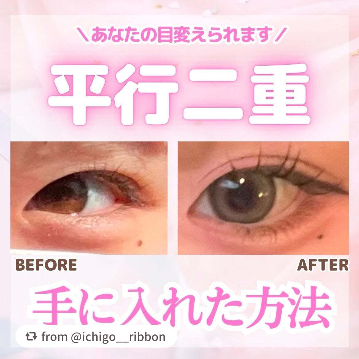 TWOOLダブルアイリッドハイブリットフィルム/SHOBIDO/二重まぶた用アイテムを使ったクチコミ(1枚目)