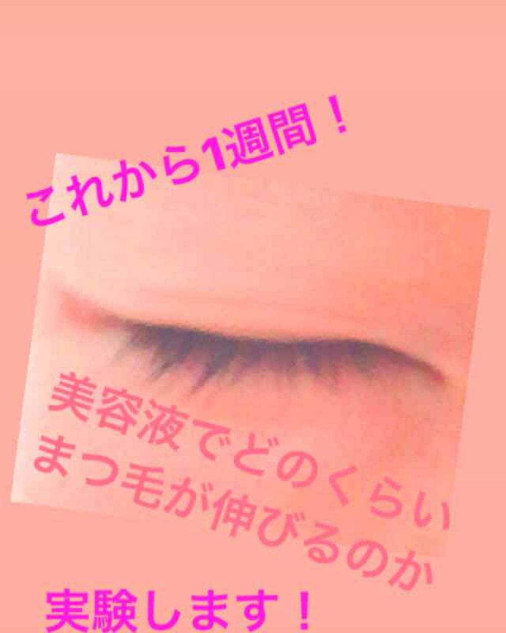 ローヤルゼリー配合 栄養ローション/DAISO/美容液を使ったクチコミ(1枚目)