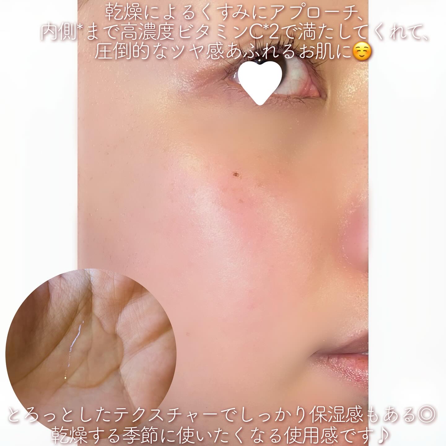 VC100エッセンスローション EX/ドクターシーラボⓇ/化粧水を使ったクチコミ（2枚目）