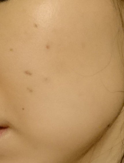 ネイチャーコンク 薬用クリアローション/ネイチャーコンク/拭き取り化粧水を使ったクチコミ(2枚目)