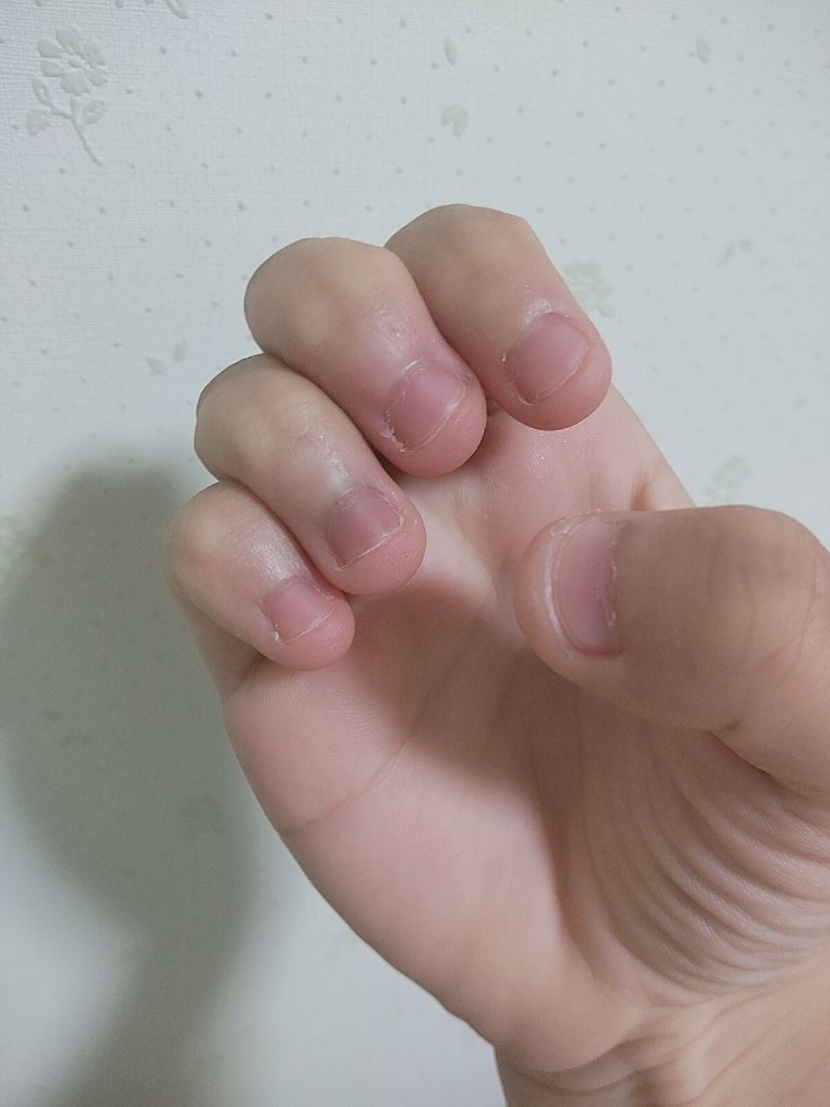 ここナ on LIPS 「皆さん初めまして!!爪を噛む癖がある中一です!よく癖で噛んでし..」(2枚目)