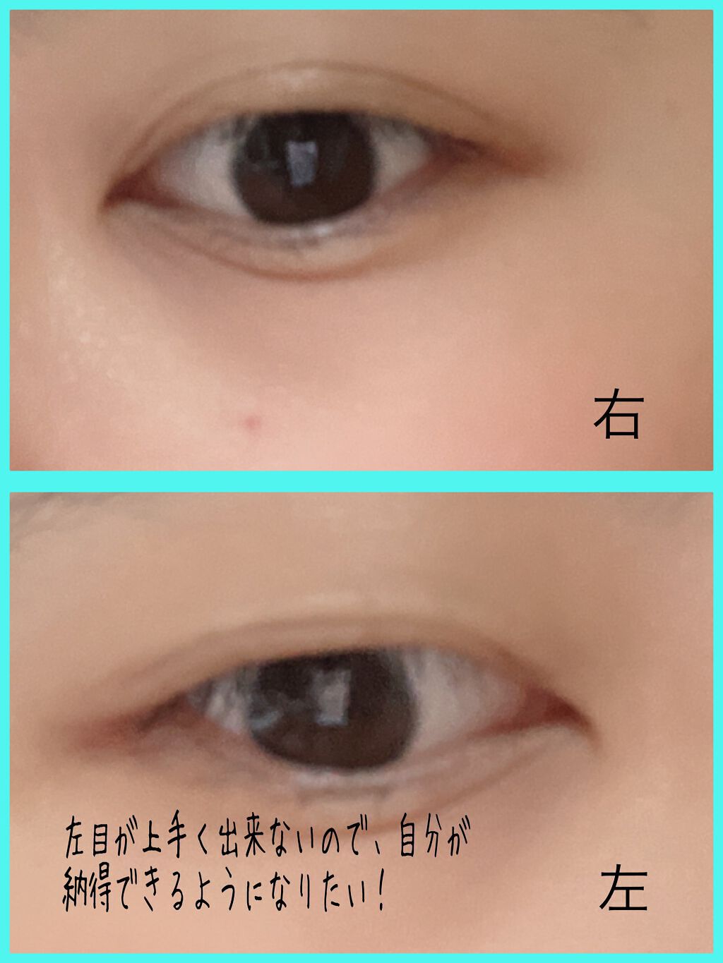 アイトーク スーパーウォータープルーフ/アイトーク/二重まぶた用アイテムを使ったクチコミ（2枚目）