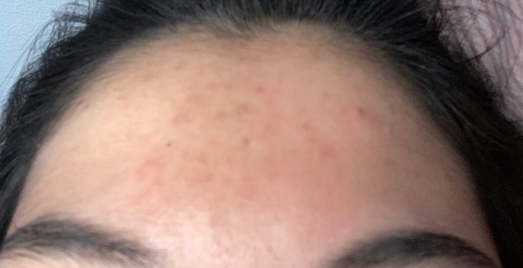 ãã on LIPS ãðžç§ããã§ãã®ããããæ²»ããæ¹æ³ðž#ã¯ãããŠã®æçš¿å
ã
èã¯ç¶ºéº..ãïŒ2æç®ïŒ