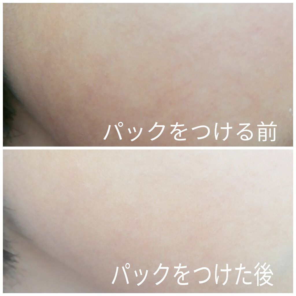 ほいっぷるん/DAISO/その他スキンケアグッズを使ったクチコミ(2枚目)