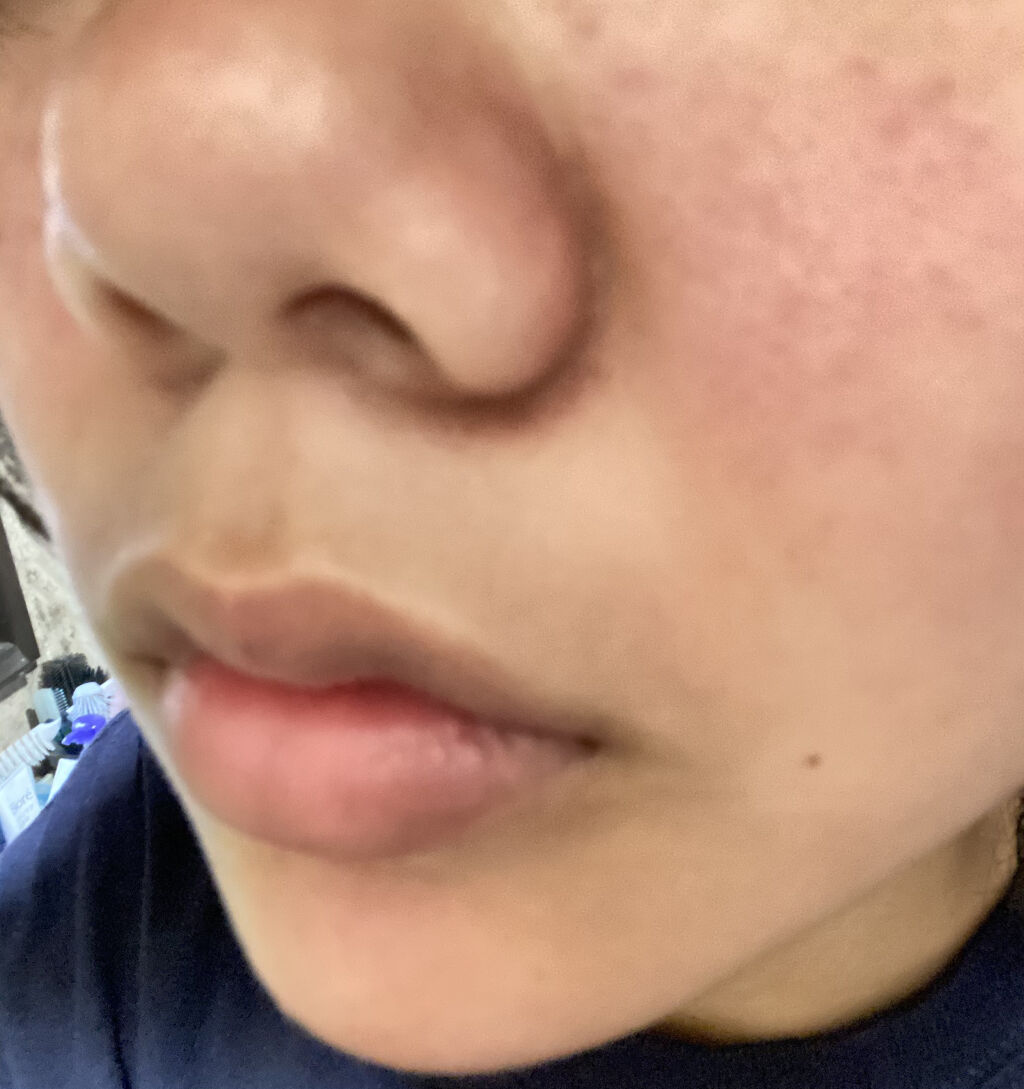 ハトムギ化粧水(ナチュリエ スキンコンディショナー R )/ナチュリエ/化粧水を使ったクチコミ（2枚目）