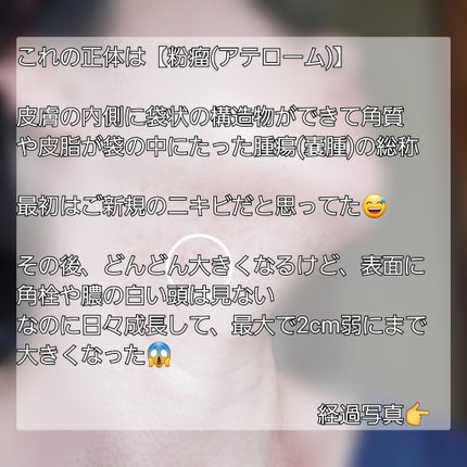 を使ったクチコミ(2枚目)