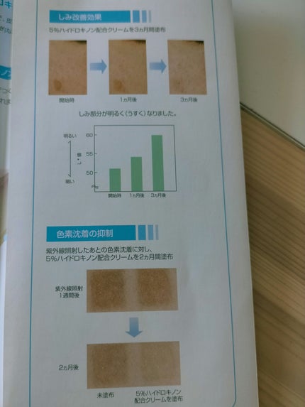 ハイドロキノン/BIHAKUEN/美容液を使ったクチコミ(4枚目)