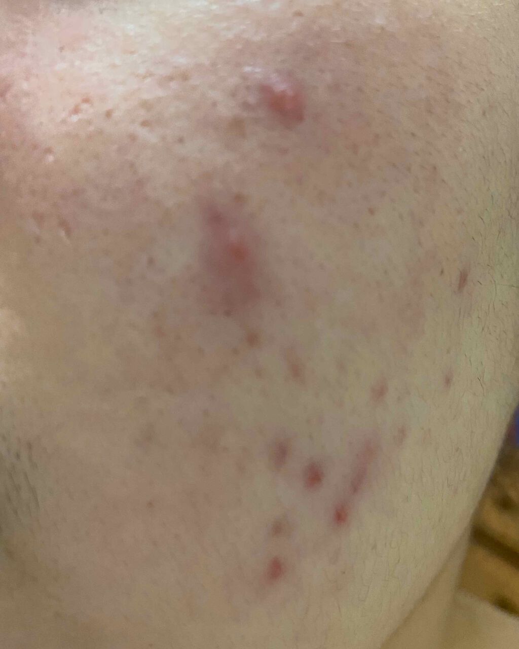 Cセラム/b.glen/美容液を使ったクチコミ（3枚目）