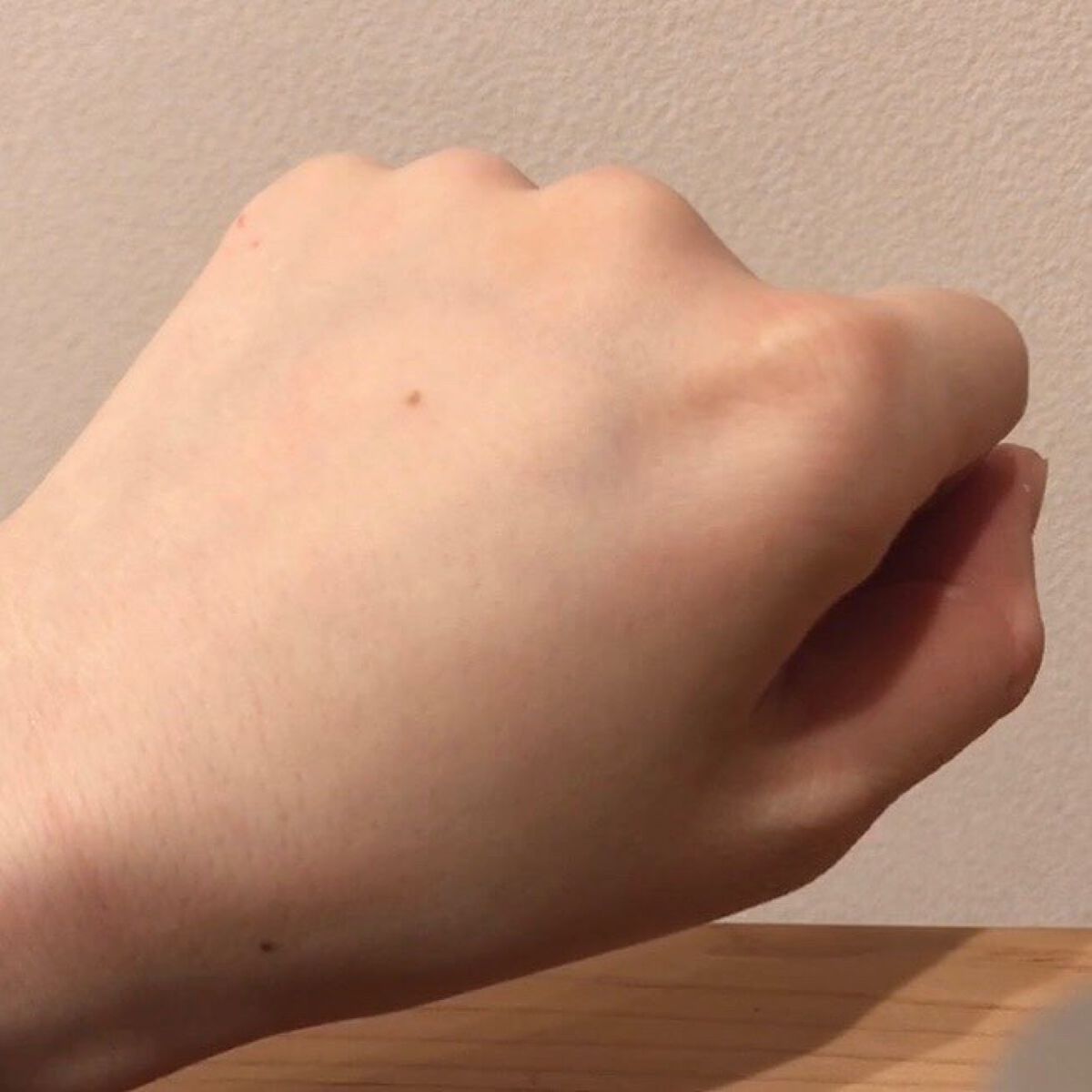 タカミスキンピール/タカミ/ブースター・導入液を使ったクチコミ(9枚目)