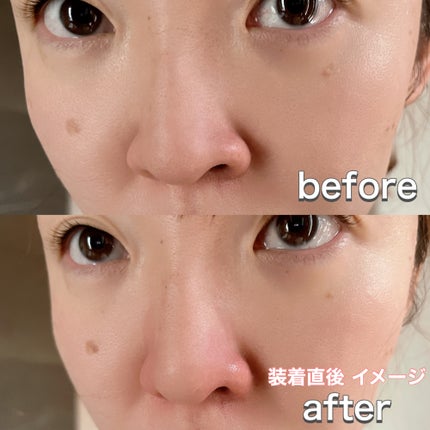 Fornez(フォーネス)/LUXCEAR/美顔器・マッサージを使ったクチコミ(4枚目)