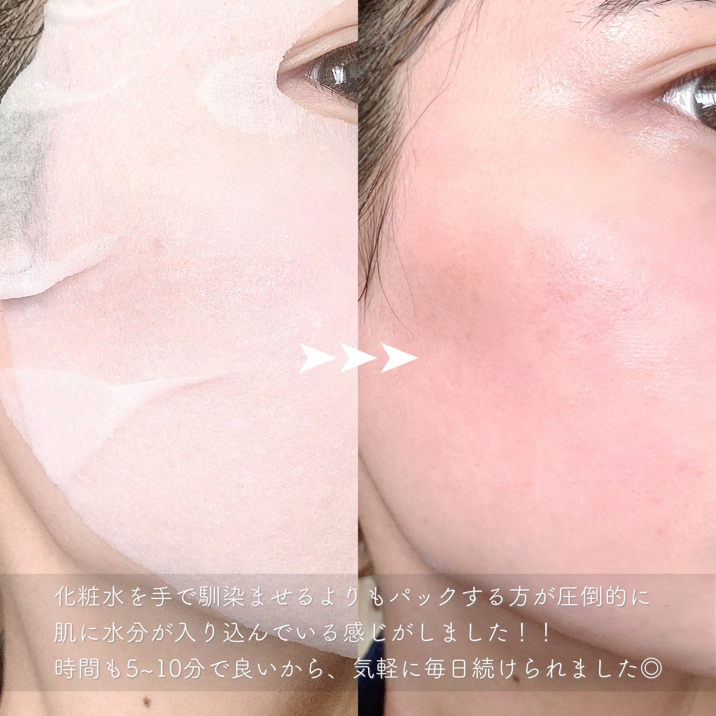 潤浸保湿 乳液/キュレル/乳液を使ったクチコミ(5枚目)